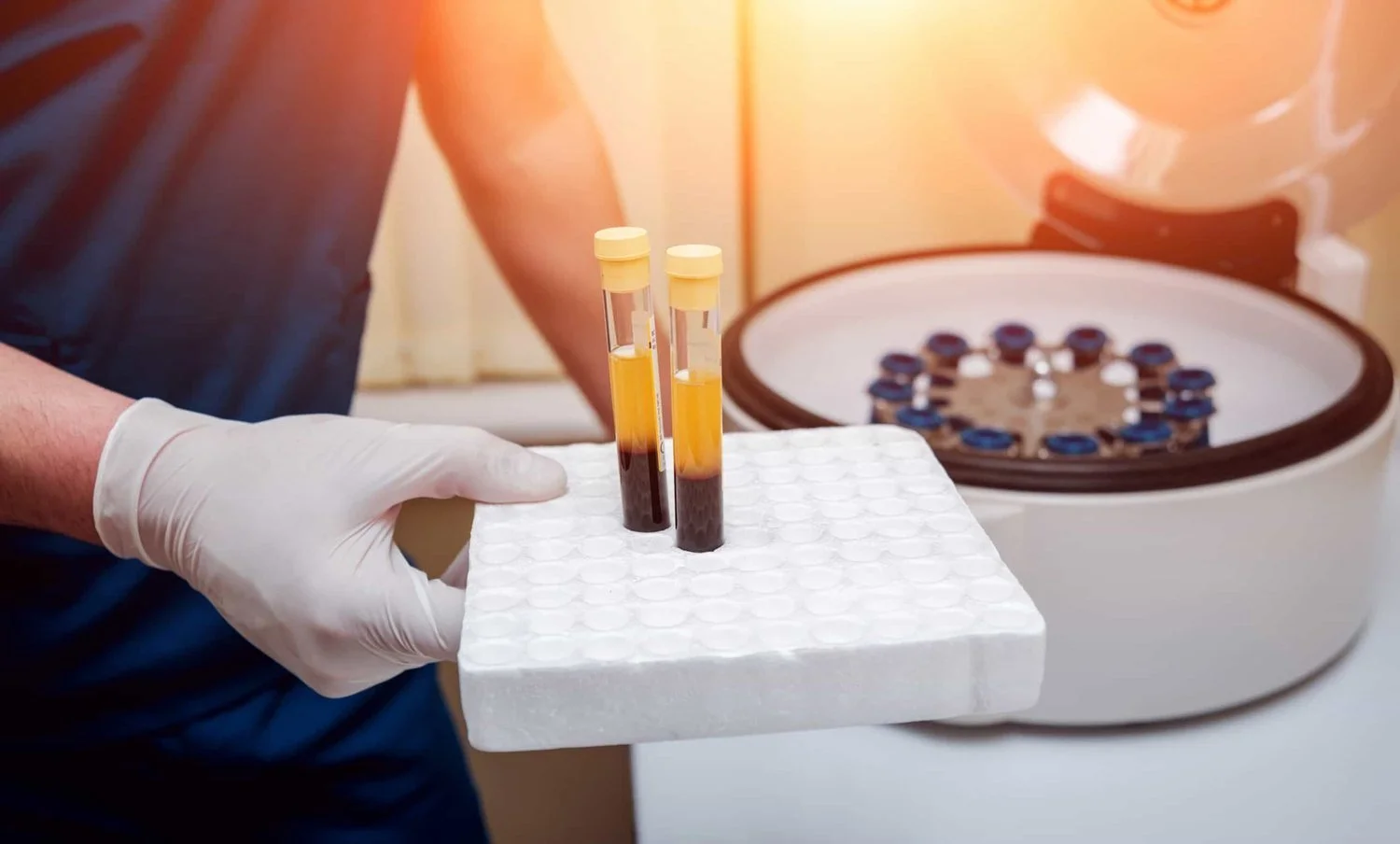 PRP+test+tubes+2